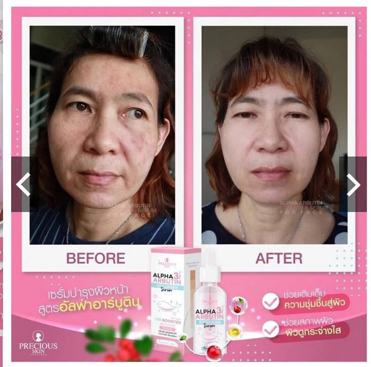 Alpha Arbutin 3+ Plus Collagen Facial Serum (50mL)