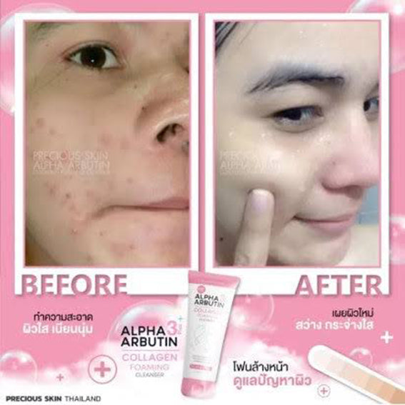 Alpha Arbutin 3+ Plus Collagen Foaming Cleanser