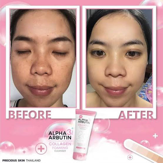 Alpha Arbutin 3+ Plus Collagen Foaming Cleanser