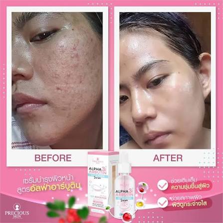 Alpha Arbutin 3+ Plus Collagen Facial Serum (50mL)