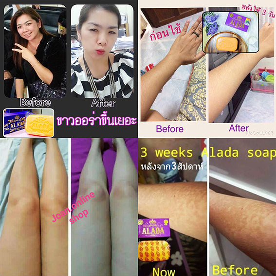 Alada Whitening Soap (160g)